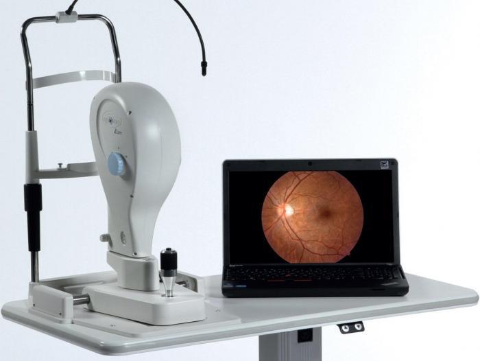 Optovue iCam 5MP Retina Camera - NOSS