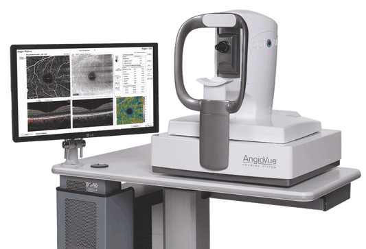 Optovue AngioVue OCTA - NOSS